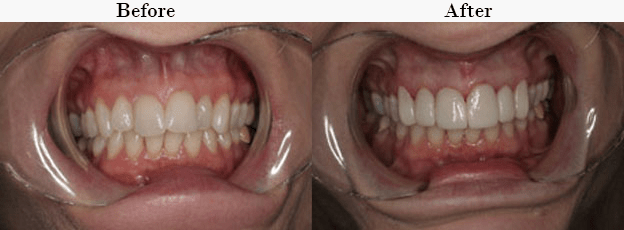 oasis dental schertz tx